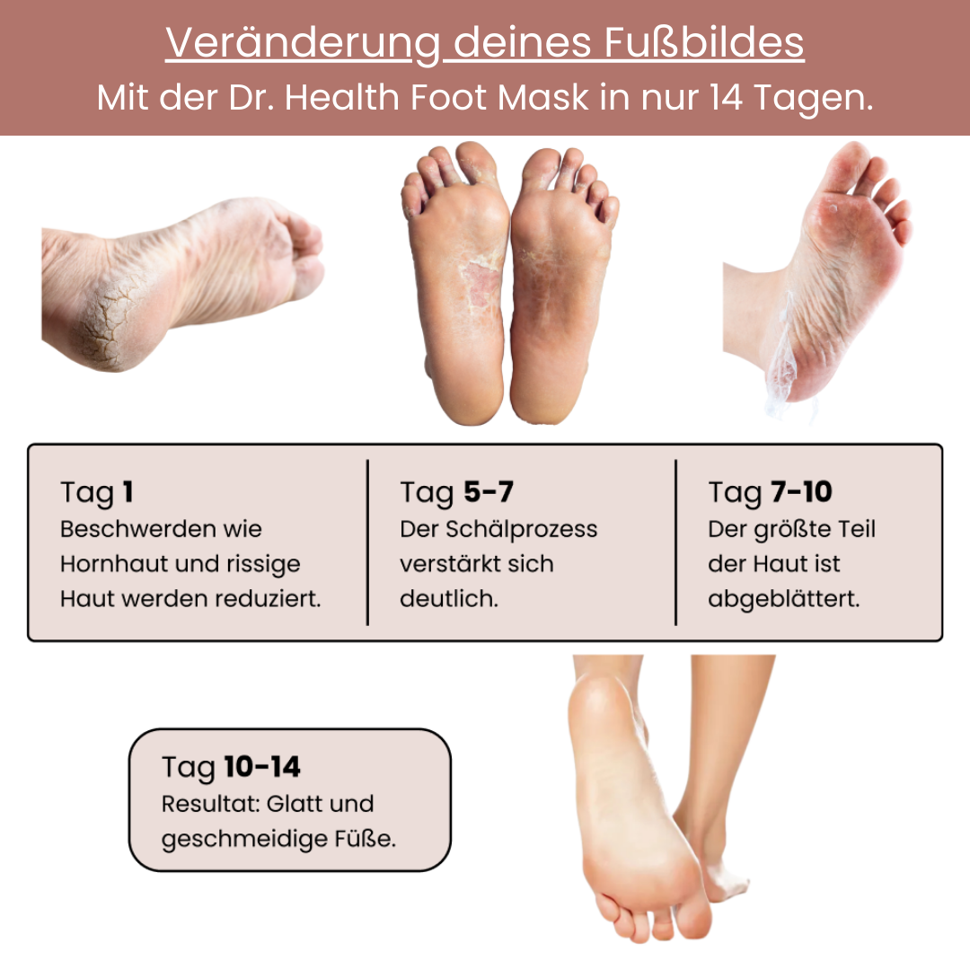 Fußmaske 14 Tage Ergebnis: Entfernung von Hornhaut und rissiger Haut, Schälprozess ab Tag 5-7, glatte und geschmeidige Füße nach 10-14 Tagen – intensive Fußpflege.