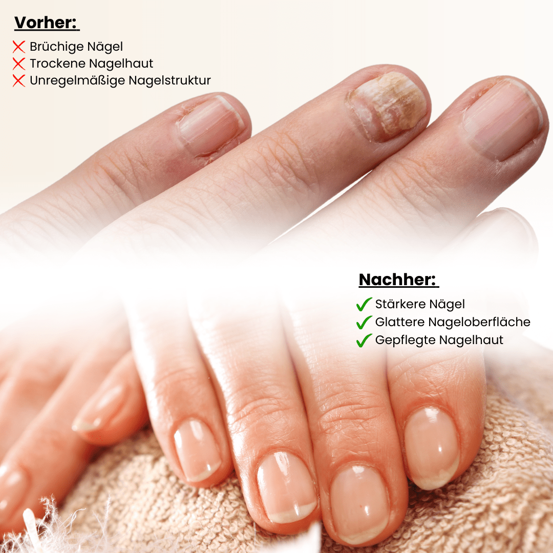 Nail Care Pen - Doktor Health